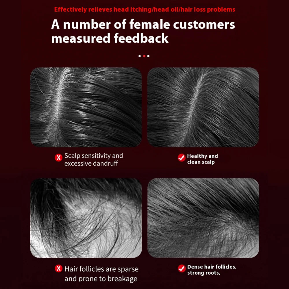 Electric Scalp Massage Brush